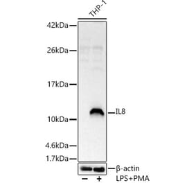Western Blot - Anti-IL-8 Antibody (A14047) - Antibodies.com