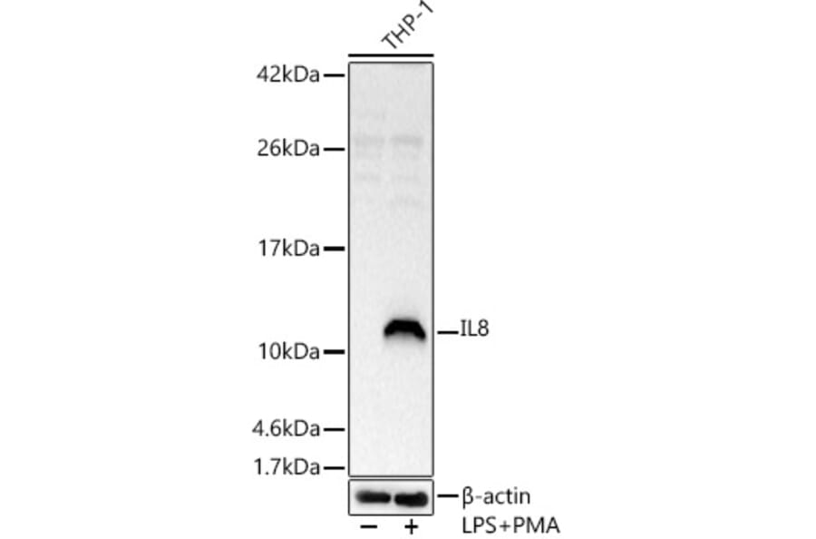 Western Blot - Anti-IL-8 Antibody (A14047) - Antibodies.com