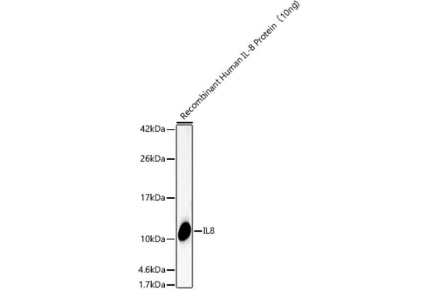 Western Blot - Anti-IL-8 Antibody (A14047) - Antibodies.com