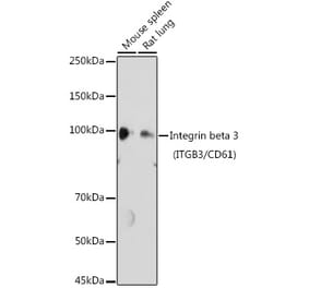Western Blot - Anti-Integrin beta 3 Antibody (A14048) - Antibodies.com