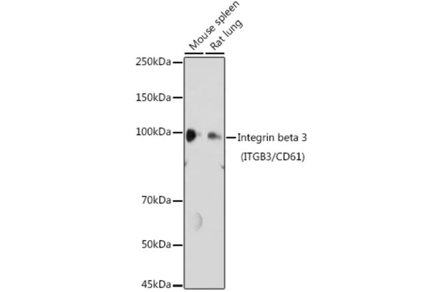 Western Blot - Anti-Integrin beta 3 Antibody (A14048) - Antibodies.com