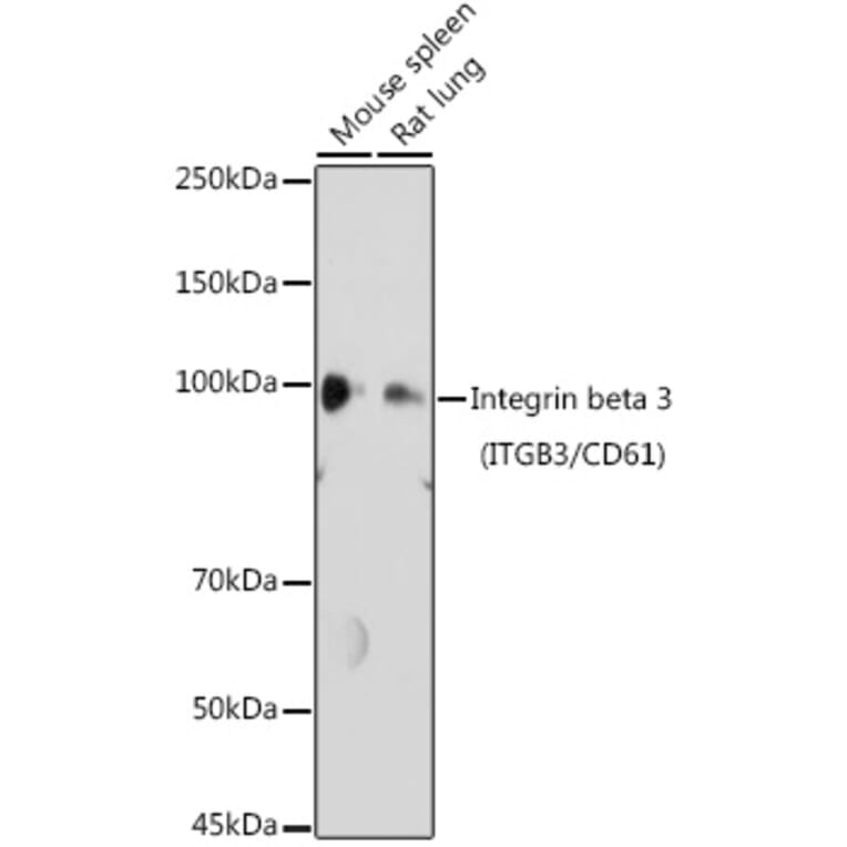 Western Blot - Anti-Integrin beta 3 Antibody (A14048) - Antibodies.com