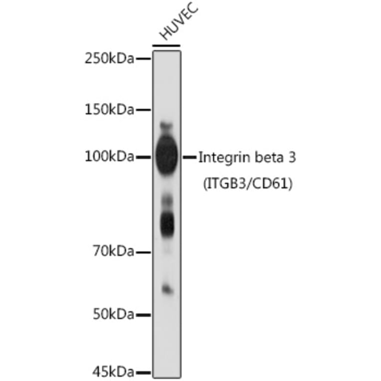 Western Blot - Anti-Integrin beta 3 Antibody (A14048) - Antibodies.com