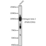 Western Blot - Anti-Integrin beta 3 Antibody (A14048) - Antibodies.com