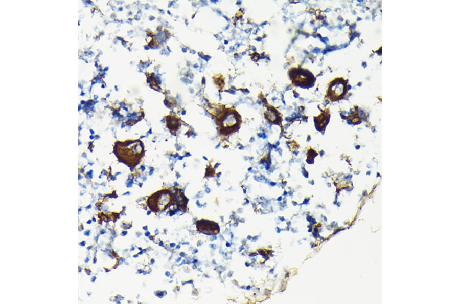 Immunohistochemistry - Anti-Integrin beta 3 Antibody (A14048) - Antibodies.com
