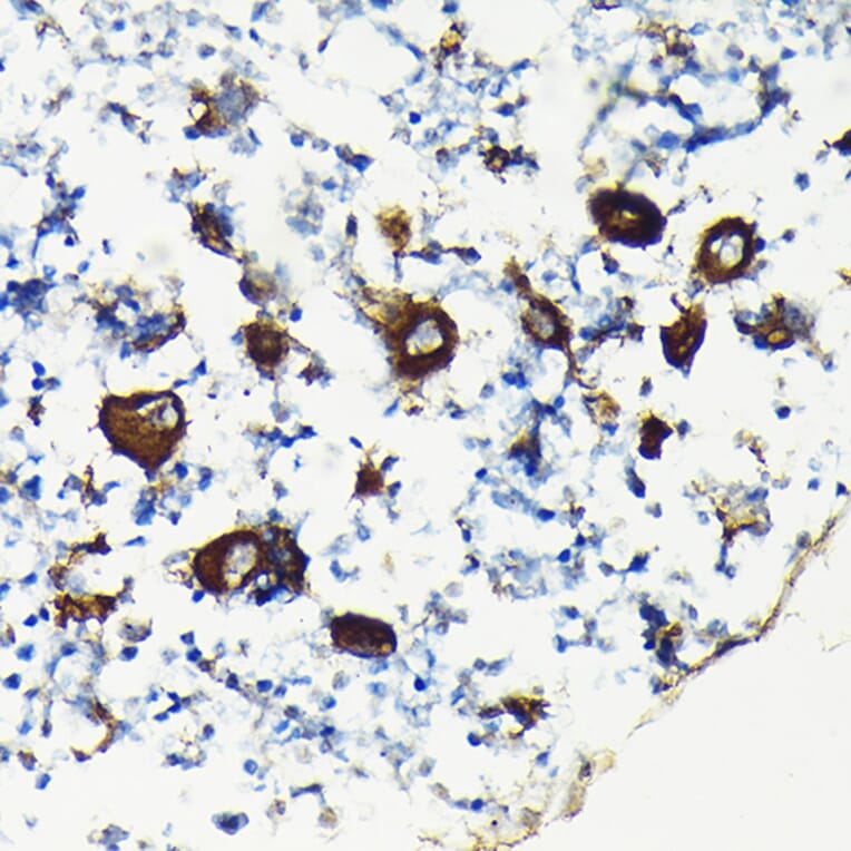 Immunohistochemistry - Anti-Integrin beta 3 Antibody (A14048) - Antibodies.com
