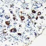 Immunohistochemistry - Anti-Integrin beta 3 Antibody (A14048) - Antibodies.com