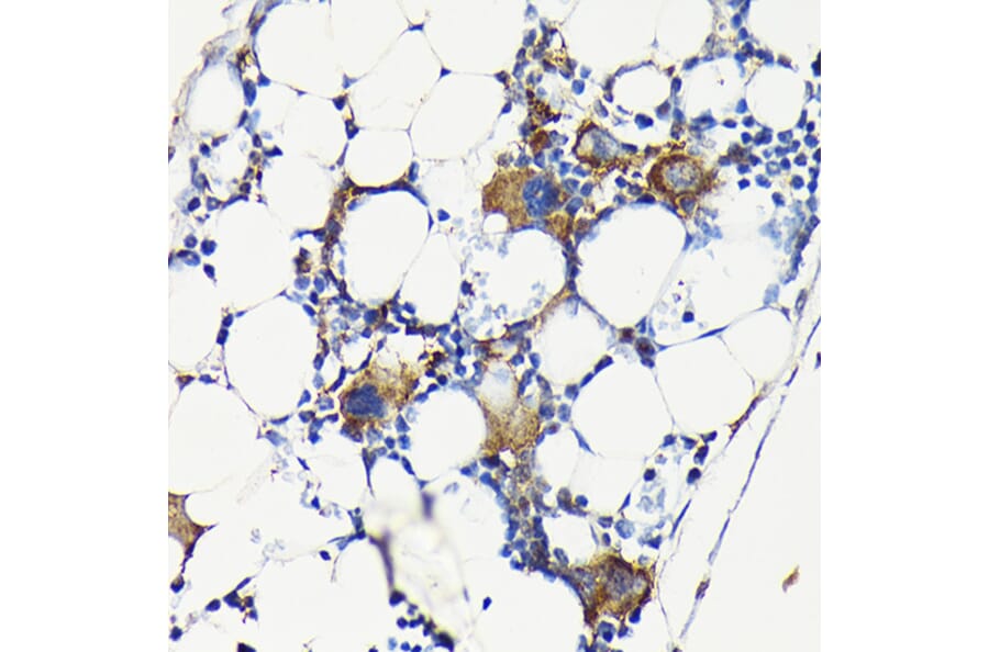 Immunohistochemistry - Anti-Integrin beta 3 Antibody (A14048) - Antibodies.com