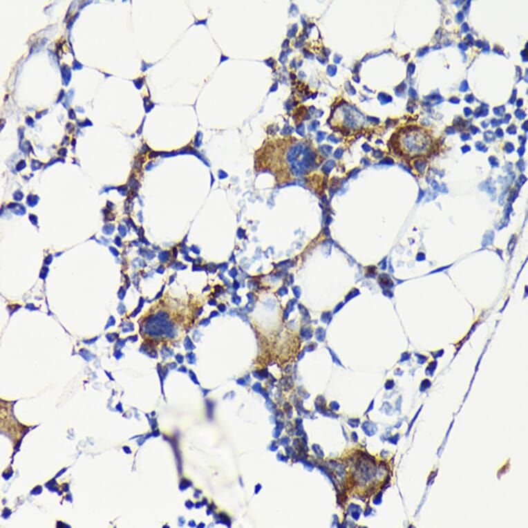 Immunohistochemistry - Anti-Integrin beta 3 Antibody (A14048) - Antibodies.com