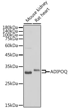 Western blot analysis of extracts of various cell lines, using Anti-ADIPOQ Antibody (A2543) at 1:1,000 dilution.
Secondary antibody: Goat Anti-Rabbit IgG (H+L) (HRP) (AS014) at 1:10,000 dilution.
Lysates / proteins: 25µg per lane.
Blocking buffer: 3% non-fat dry milk in TBST.
Detection: ECL Enhanced Kit (RM00021).
Exposure time: 30s.