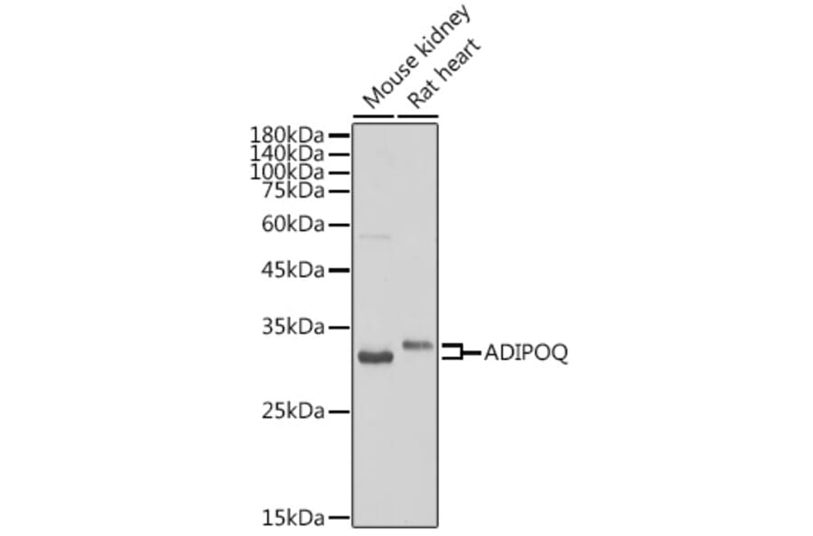 Western Blot - Anti-Adiponectin Antibody (A14049) - Antibodies.com