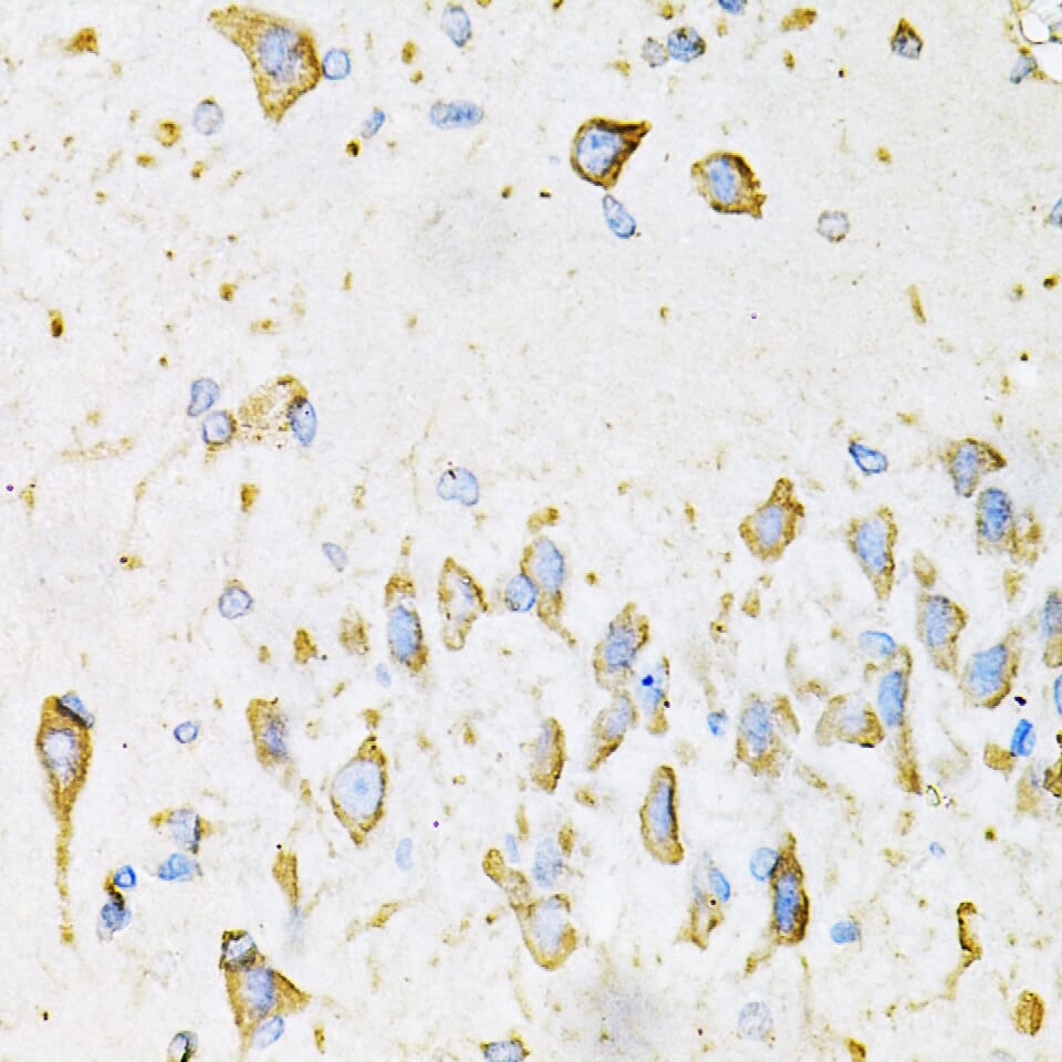 Immunohistochemistry of paraffin-embedded mouse kidney using Anti-ADIPOQ Antibody (A2543) at dilution of 1:100 (40x lens).