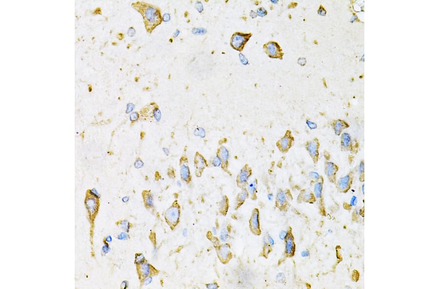Immunohistochemistry - Anti-Adiponectin Antibody (A14049) - Antibodies.com