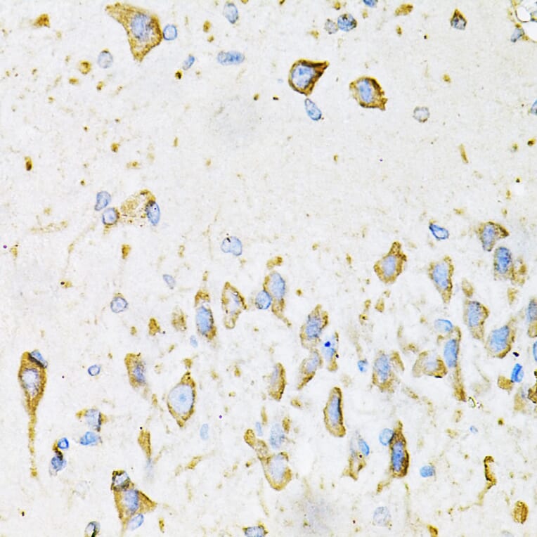 Immunohistochemistry - Anti-Adiponectin Antibody (A14049) - Antibodies.com