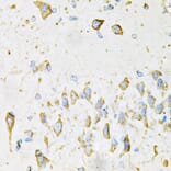 Immunohistochemistry - Anti-Adiponectin Antibody (A14049) - Antibodies.com