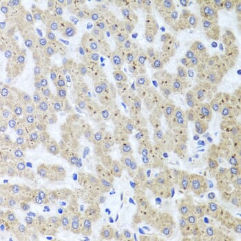 Immunohistochemistry of paraffin-embedded human liver injury using Anti-ADIPOQ Antibody (A2543) at dilution of 1:100 (40x lens).