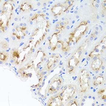 Immunohistochemistry of paraffin-embedded rat kidney using Anti-ADIPOQ Antibody (A2543) at dilution of 1:100 (40x lens).