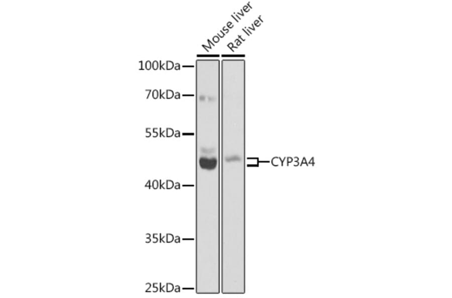 Western Blot - Anti-Cytochrome P450 3A4/CYP3A4 Antibody (A14050) - Antibodies.com