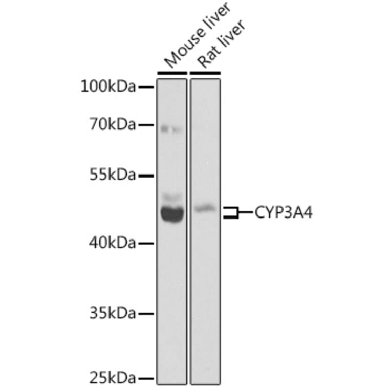 Western Blot - Anti-Cytochrome P450 3A4/CYP3A4 Antibody (A14050) - Antibodies.com