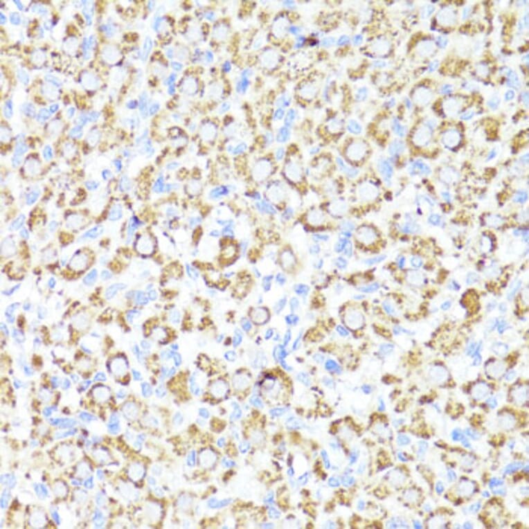 Immunohistochemistry - Anti-Cytochrome P450 3A4/CYP3A4 Antibody (A14050) - Antibodies.com