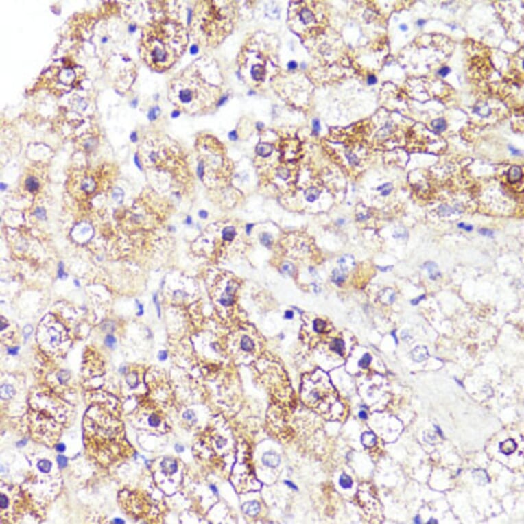Immunohistochemistry - Anti-Cytochrome P450 3A4/CYP3A4 Antibody (A14050) - Antibodies.com