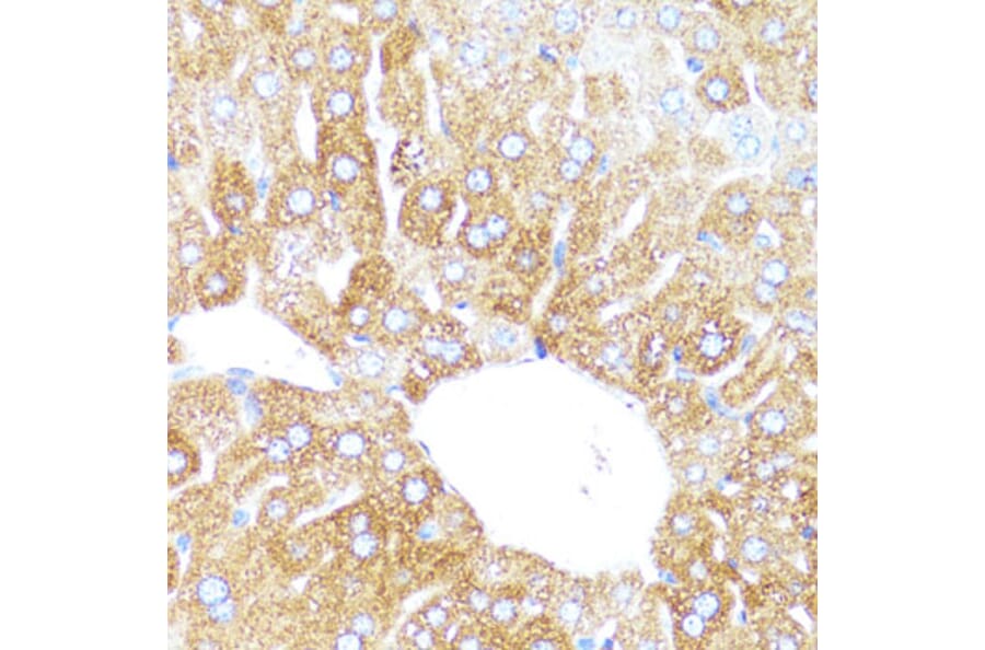 Immunohistochemistry - Anti-Cytochrome P450 3A4/CYP3A4 Antibody (A14050) - Antibodies.com