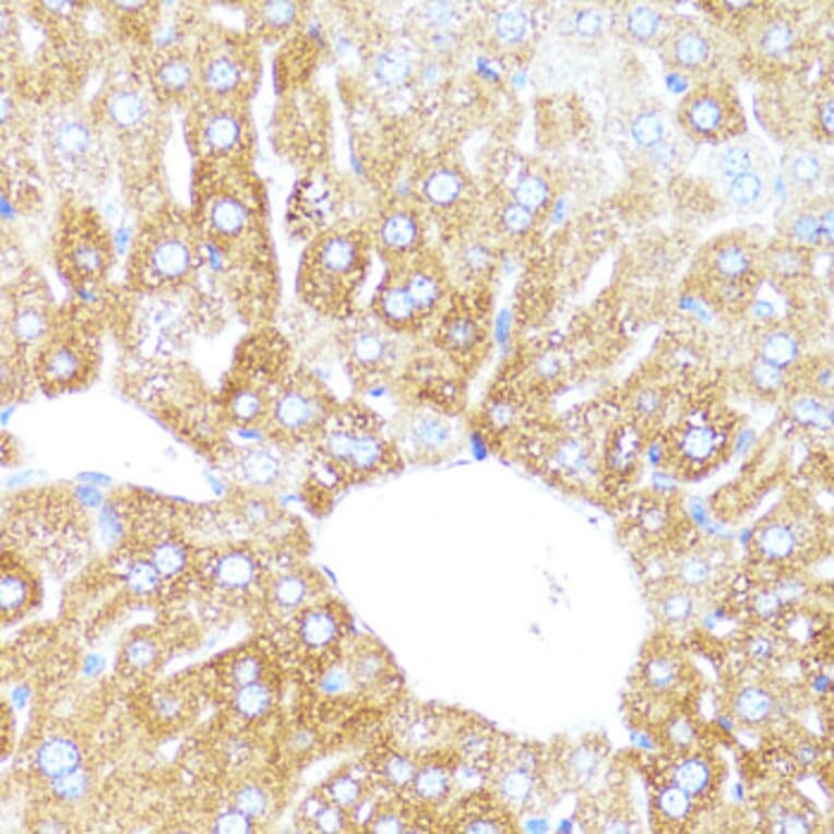 Immunohistochemistry - Anti-Cytochrome P450 3A4/CYP3A4 Antibody (A14050) - Antibodies.com
