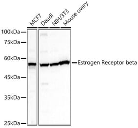 Western Blot - Anti-Estrogen Receptor beta Antibody (A14051) - Antibodies.com