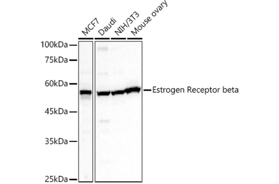 Western Blot - Anti-Estrogen Receptor beta Antibody (A14051) - Antibodies.com
