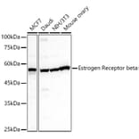 Western Blot - Anti-Estrogen Receptor beta Antibody (A14051) - Antibodies.com