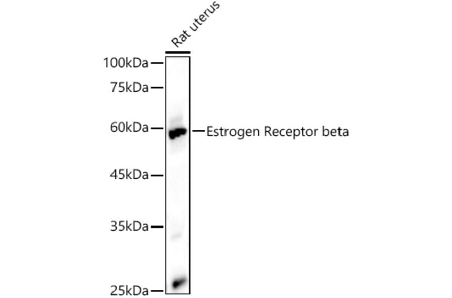Western Blot - Anti-Estrogen Receptor beta Antibody (A14051) - Antibodies.com