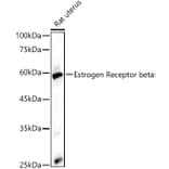 Western Blot - Anti-Estrogen Receptor beta Antibody (A14051) - Antibodies.com