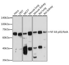 Western Blot - Anti-NF-kB p65 Antibody (A14052) - Antibodies.com