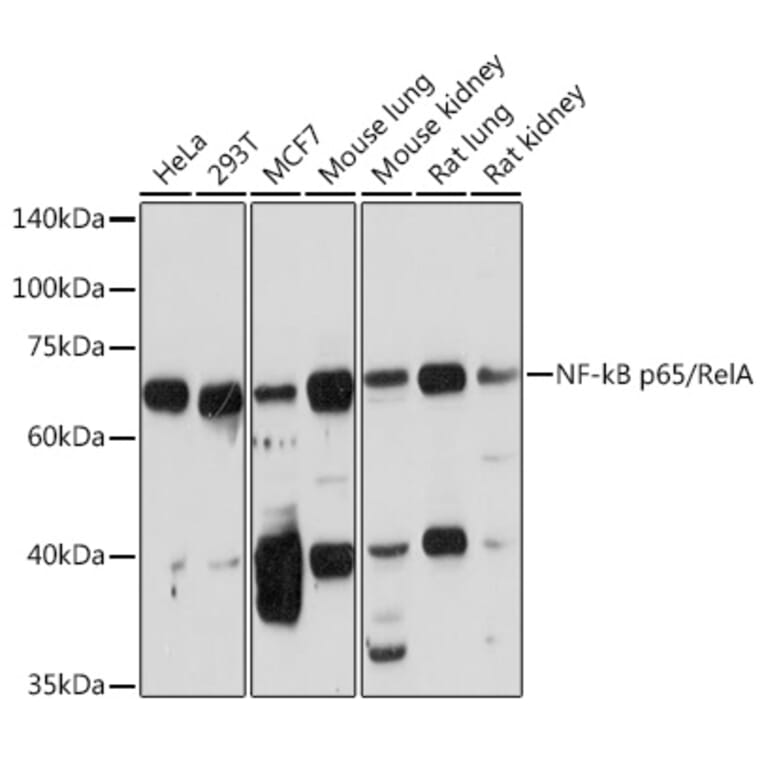 Western Blot - Anti-NF-kB p65 Antibody (A14052) - Antibodies.com
