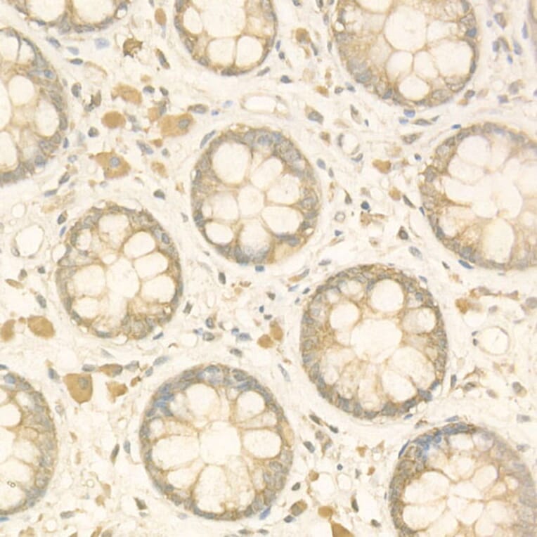 Immunohistochemistry - Anti-NF-kB p65 Antibody (A14052) - Antibodies.com