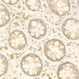 Immunohistochemistry - Anti-NF-kB p65 Antibody (A14052) - Antibodies.com