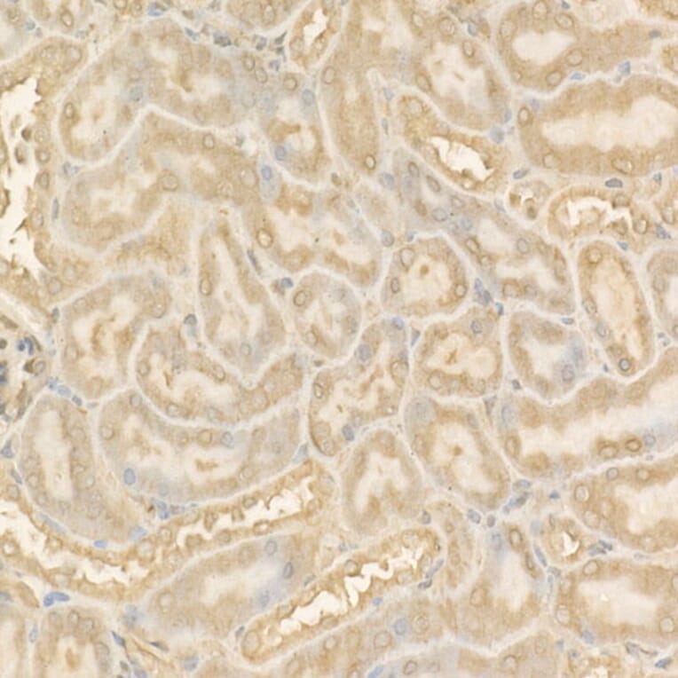 Immunohistochemistry - Anti-NF-kB p65 Antibody (A14052) - Antibodies.com