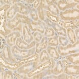 Immunohistochemistry - Anti-NF-kB p65 Antibody (A14052) - Antibodies.com