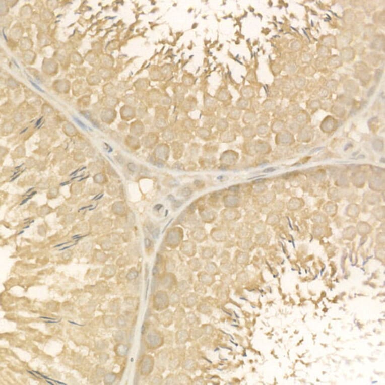 Immunohistochemistry - Anti-NF-kB p65 Antibody (A14052) - Antibodies.com