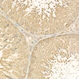 Immunohistochemistry - Anti-NF-kB p65 Antibody (A14052) - Antibodies.com