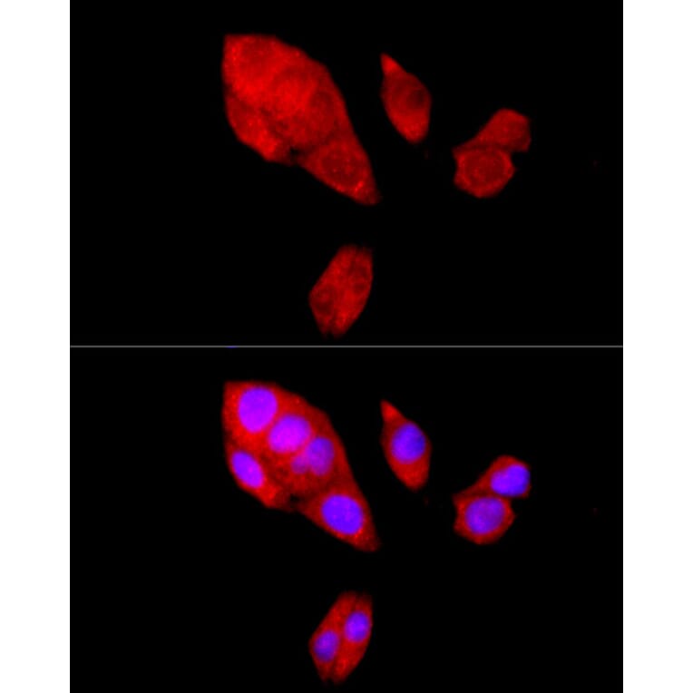 Immunofluorescence - Anti-NF-kB p65 Antibody (A14052) - Antibodies.com