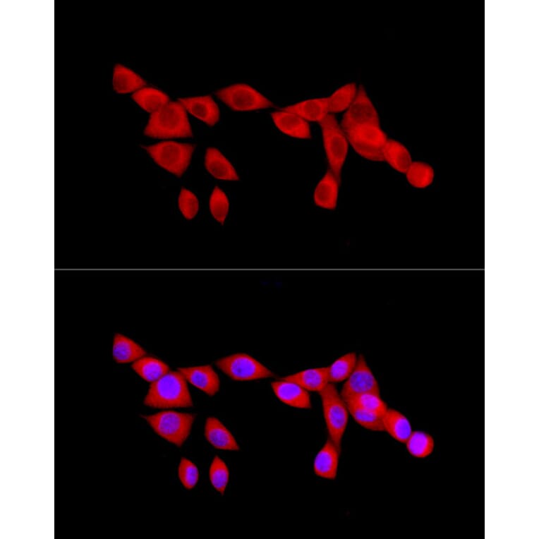 Immunofluorescence - Anti-NF-kB p65 Antibody (A14052) - Antibodies.com