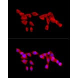 Immunofluorescence - Anti-NF-kB p65 Antibody (A14052) - Antibodies.com