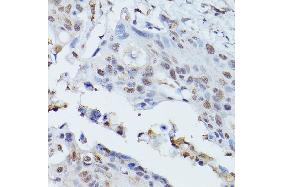 Immunohistochemistry - Anti-PLK1 Antibody (A14053) - Antibodies.com