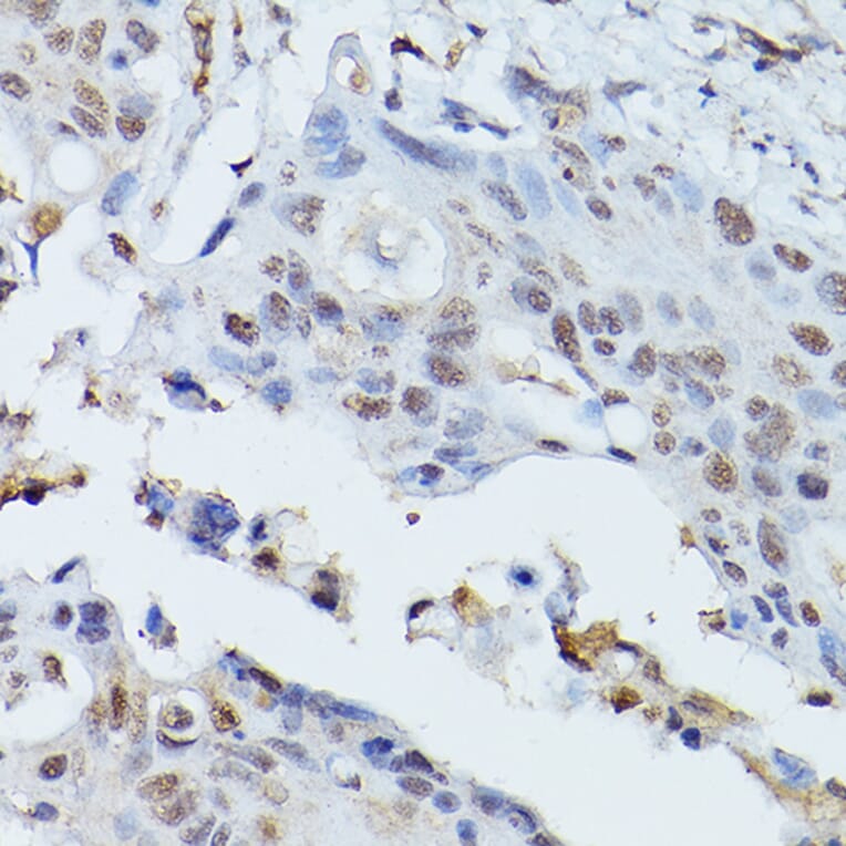 Immunohistochemistry - Anti-PLK1 Antibody (A14053) - Antibodies.com