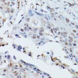 Immunohistochemistry - Anti-PLK1 Antibody (A14053) - Antibodies.com