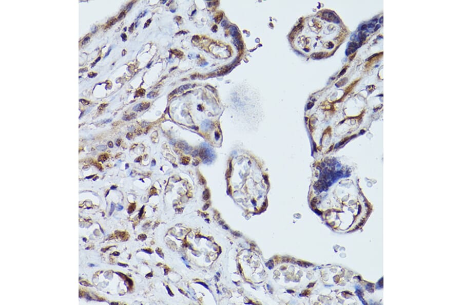 Immunohistochemistry - Anti-PLK1 Antibody (A14053) - Antibodies.com