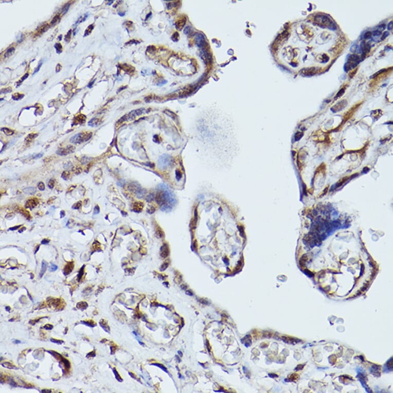 Immunohistochemistry - Anti-PLK1 Antibody (A14053) - Antibodies.com