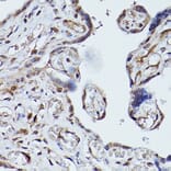 Immunohistochemistry - Anti-PLK1 Antibody (A14053) - Antibodies.com