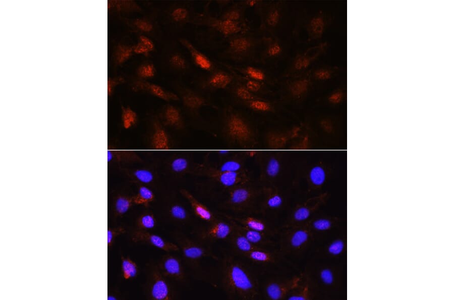 Immunofluorescence - Anti-PLK1 Antibody (A14053) - Antibodies.com